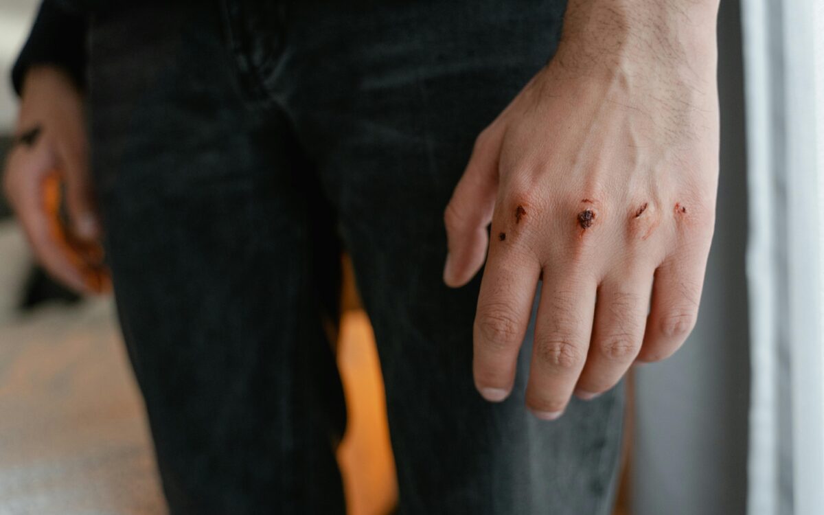 Schlaegerei Schlaegerei